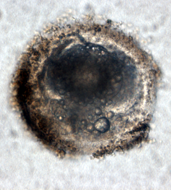 SetWidth600-embryo